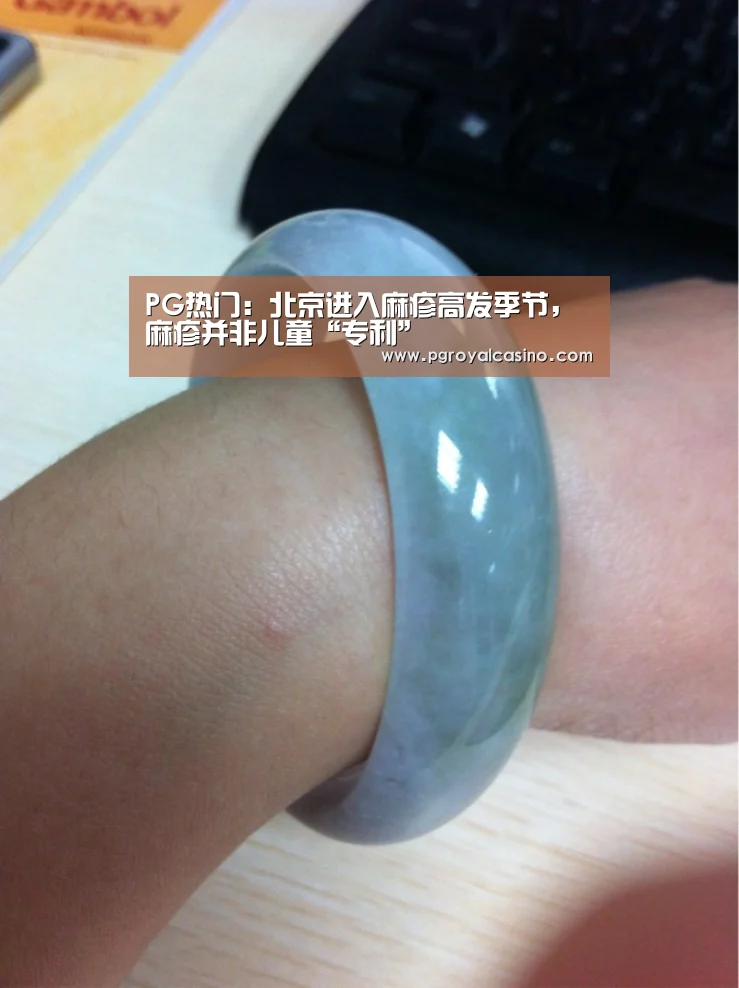 PG热门:北京进入麻疹高发季节,麻疹并非儿童“专利”(图2) PG官方